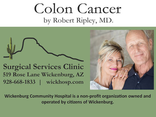 Colon Cancer by Robert Ripley, MD.