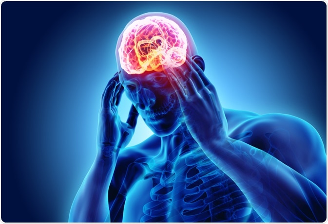 Suffer from Migraine Headaches?