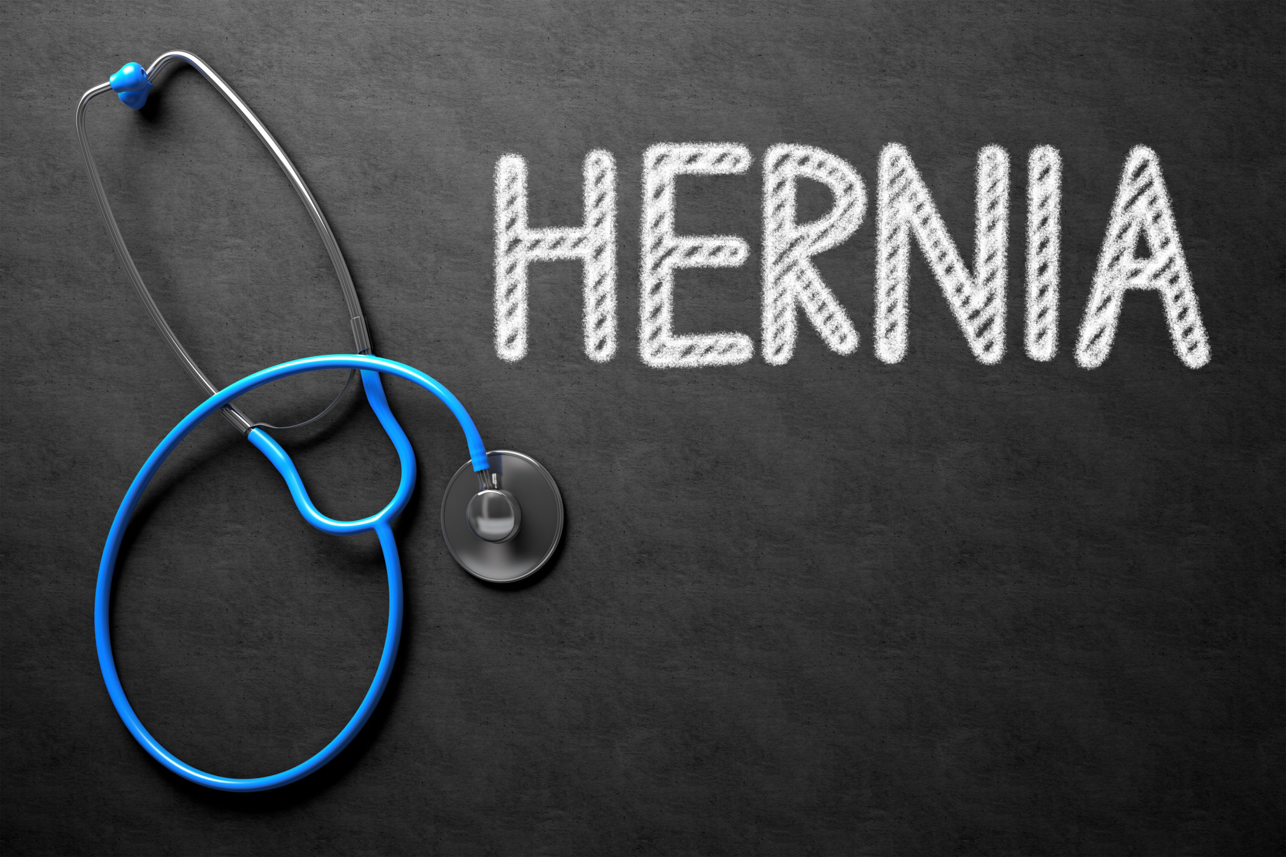 What is a Hernia and How Do You Fix it?