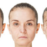 Options for Aging Skin